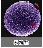 无精症.jpg